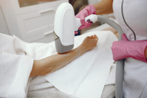 Smart Hair Removal Equipment Ensuring Long-Lasting Smoothness with Advanced Precision